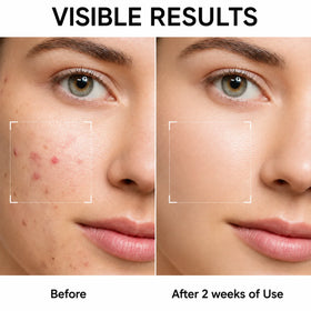 Zenmira Volcanic Pore Clay Stick — before after face