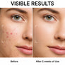 Zenmira Volcanic Pore Clay Stick — before after face