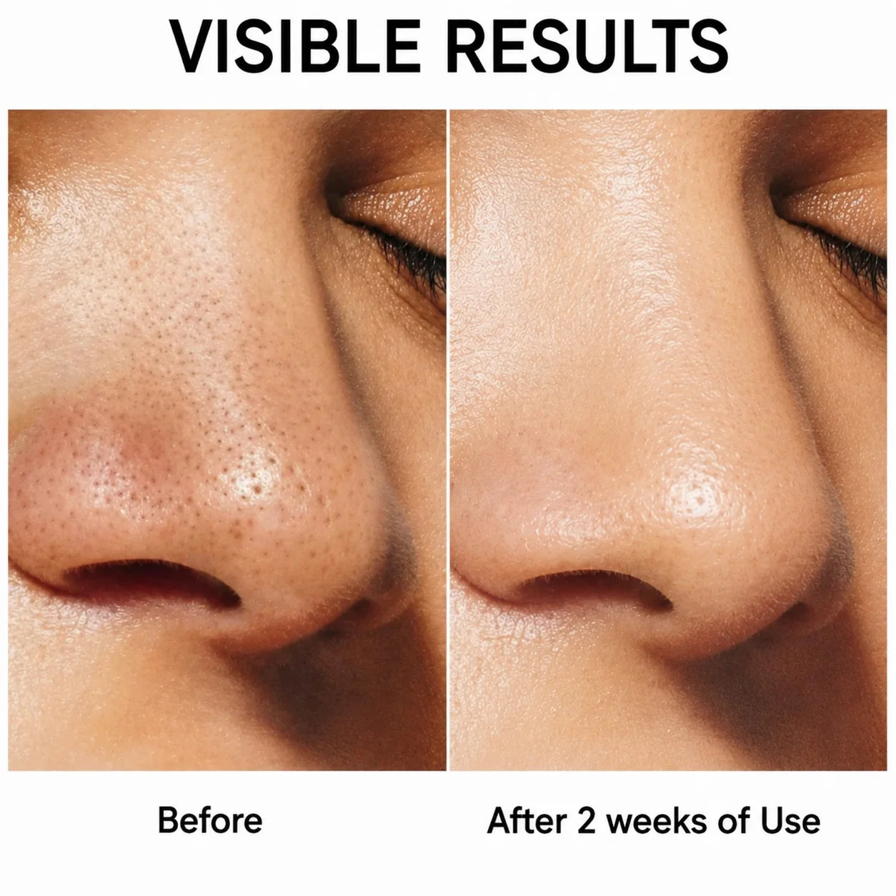 Zenmira Volcanic Pore Clay Stick — before after nose