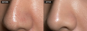 Zenmira Volcanic Pore Clay Stick — review ba 2