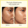 Zenmira Darkspot Serum Patch — results look
