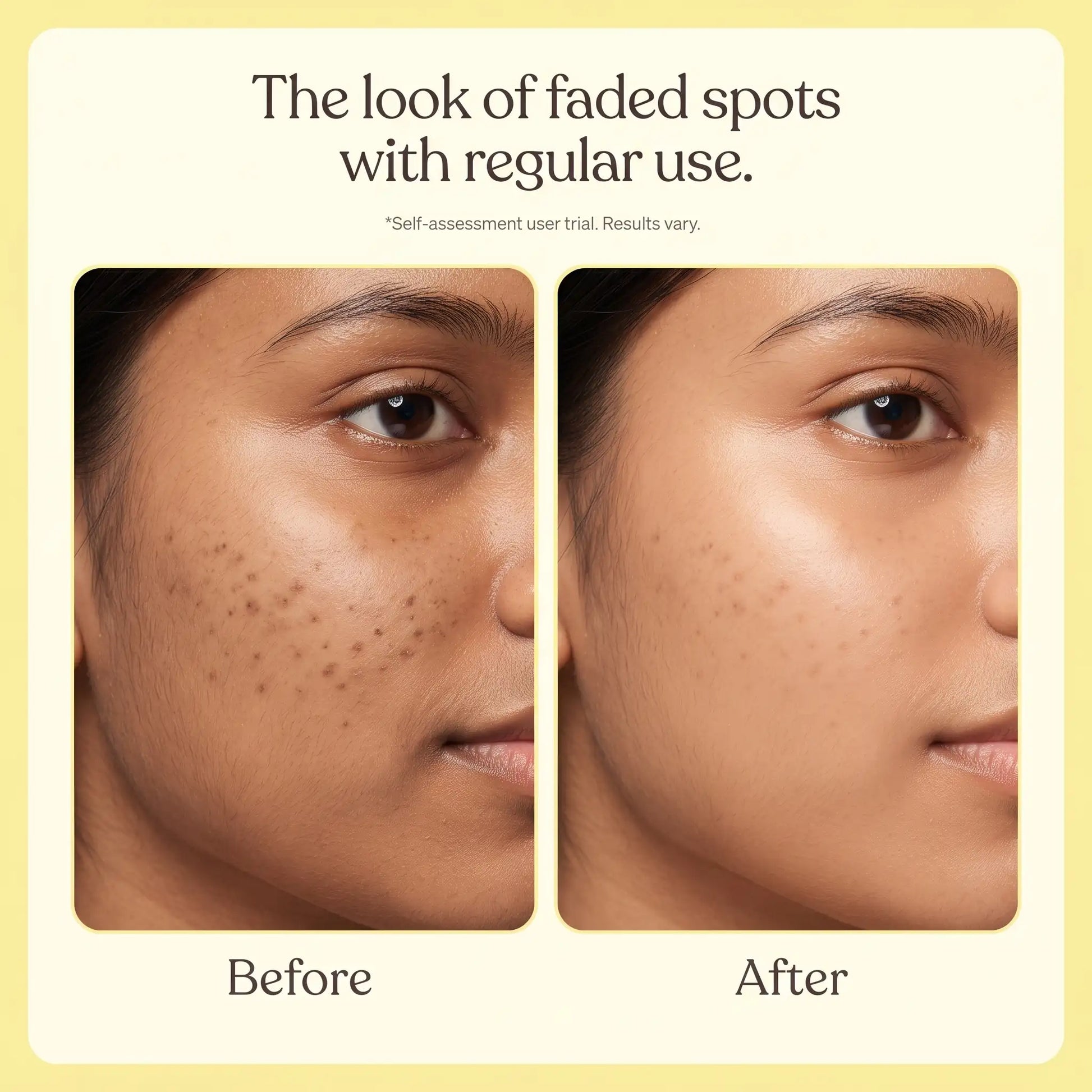 Zenmira Darkspot Serum Patch — results look