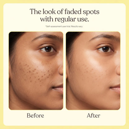 Zenmira Darkspot Serum Patch — results look