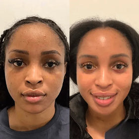 Zenmira Collagen Night Wrapping Mask — before after