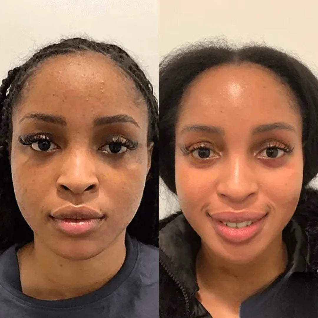 Zenmira Collagen Night Wrapping Mask — before after