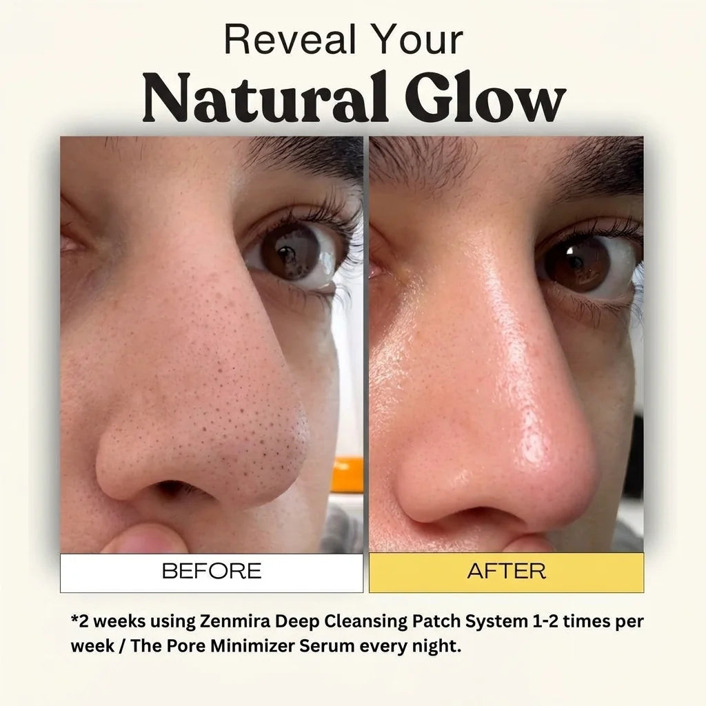 Zenmira Pore Cleansing Patch System — before after
