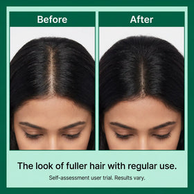 Zenmira Microneedling Spicule Serum — results look