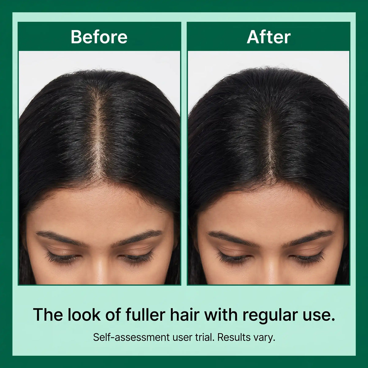 Zenmira Microneedling Spicule Serum — results look