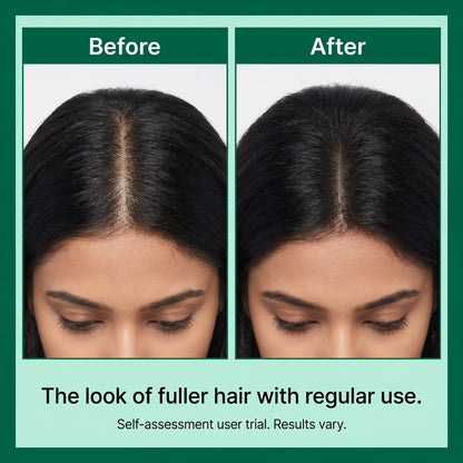 Zenmira Microneedling Spicule Serum — results look