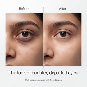 Zenmira Vibrating Eye Cream — results look